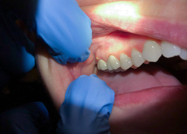 Best Cosmetic Emergency Dentistry in Aviston, IL