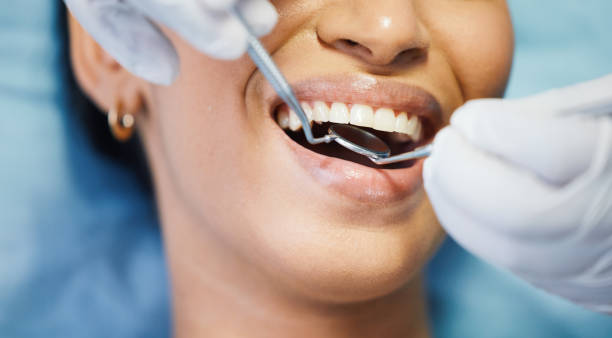 Best Emergency Orthodontic Services in Aviston, IL
